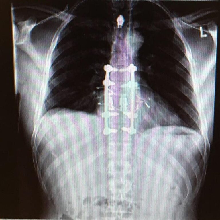 From Potential Paralysis To Profits