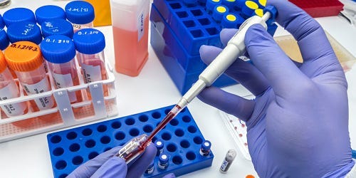 New Research Suggests You Might Be Able to Measure Organ Age